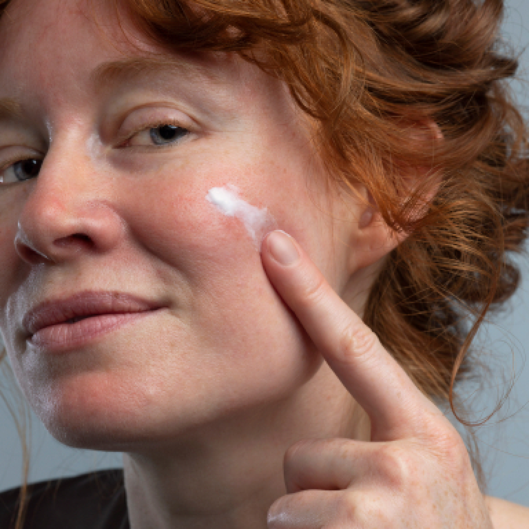 Rosacea + Eye Health: What’s the Connection?
