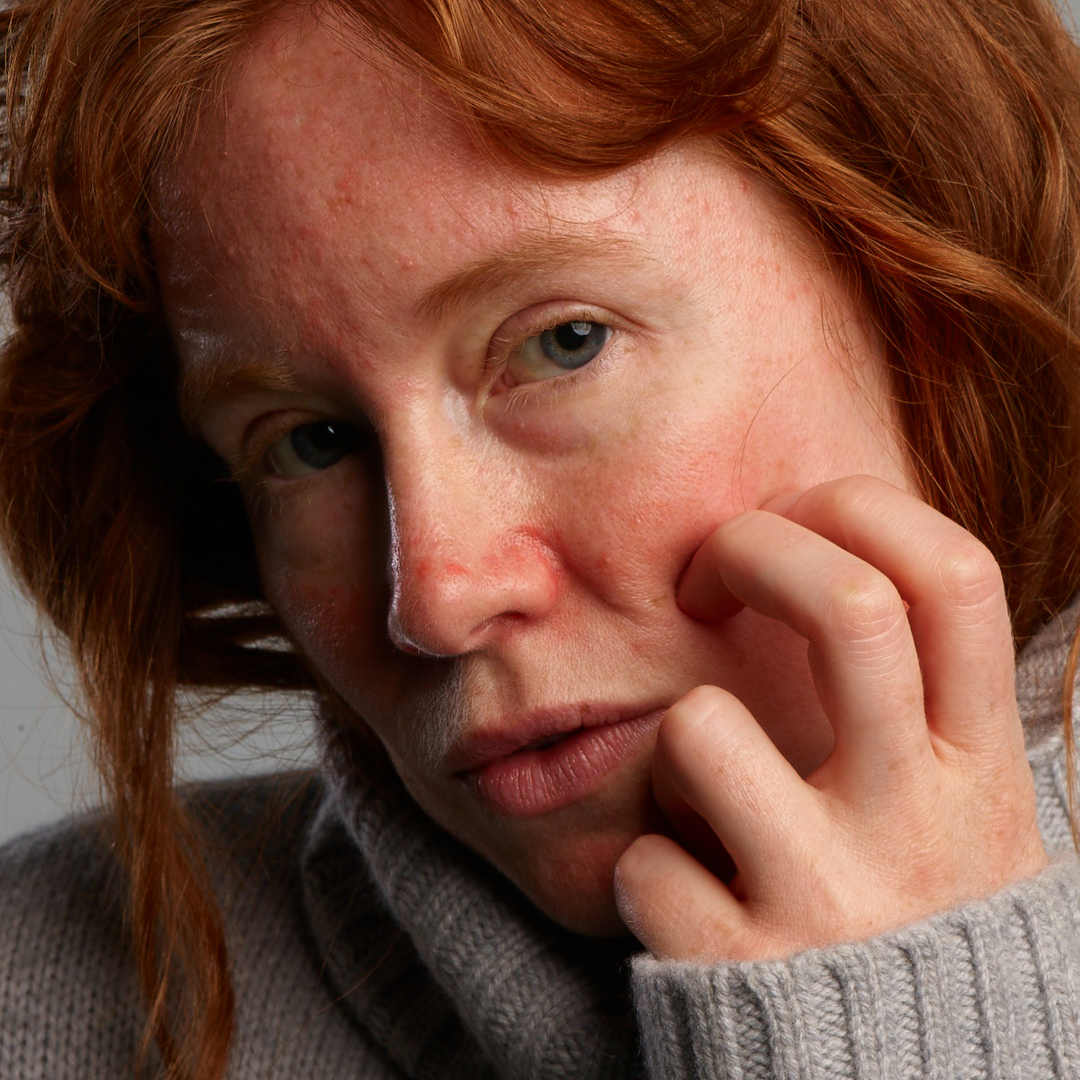 Rosacear Face Care Set