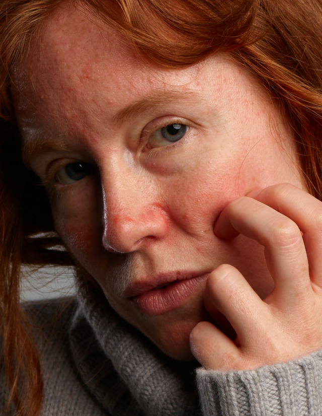 Rosacear Face Care Set Rosacear Face Care Set